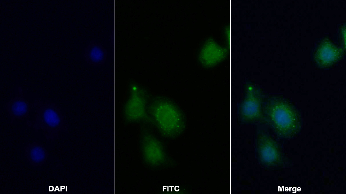 Polyclonal Antibody to Autophagy Related Protein 16 Like Protein 1 (ATG16L1)