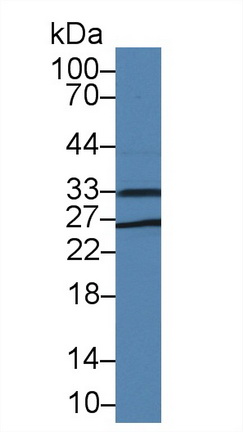 Polyclonal Antibody to Dickkopf Like Protein 1 (DKKL1)