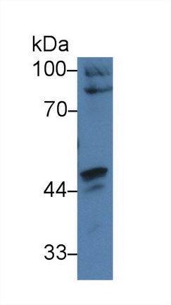 Polyclonal Antibody to Caspase Recruitment Domain Family, Member 9 (CARD9)