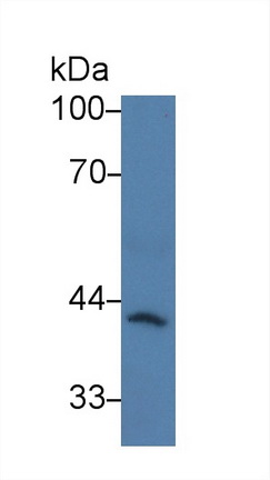 Polyclonal Antibody to Caspase Recruitment Domain Family, Member 9 (CARD9)