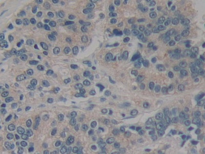 Polyclonal Antibody to Caspase Recruitment Domain Family, Member 9 (CARD9)