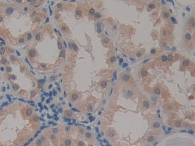 Polyclonal Antibody to Caspase Recruitment Domain Family, Member 9 (CARD9)