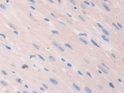 Polyclonal Antibody to Caspase Recruitment Domain Family, Member 9 (CARD9)