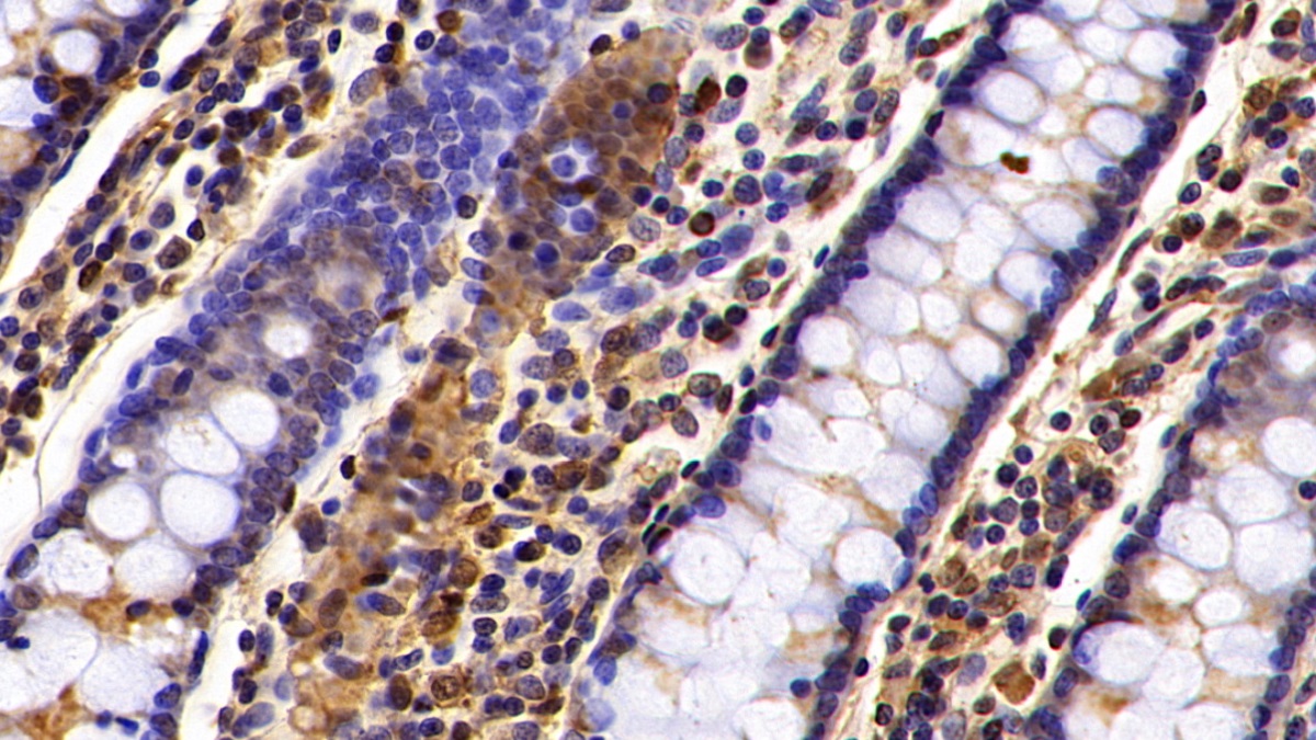 Polyclonal Antibody to Suppression Of Tumorigenicity 14 (ST14)