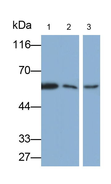 Polyclonal Antibody to RAD23 Homolog B (RAD23B)