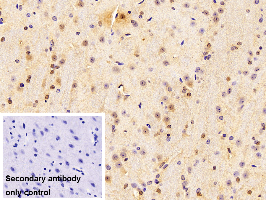 Polyclonal Antibody to RAD23 Homolog B (RAD23B)