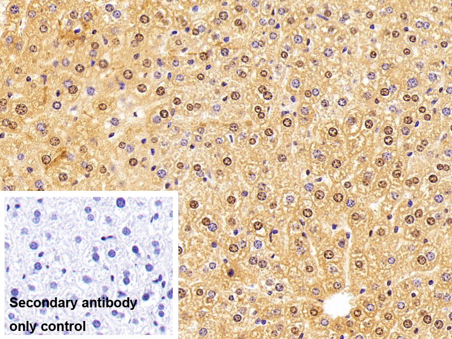 Polyclonal Antibody to RAD23 Homolog B (RAD23B)