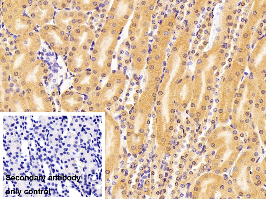 Polyclonal Antibody to RAD23 Homolog B (RAD23B)