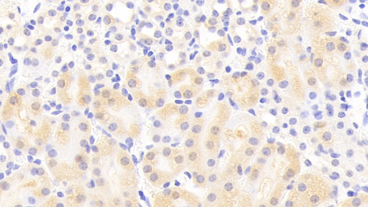 Polyclonal Antibody to Pim-2 Oncogene (PIM2)