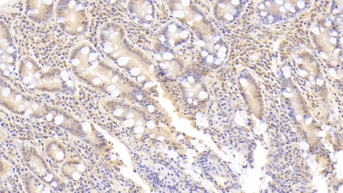 Polyclonal Antibody to IK Cytokine, Down Regulator Of HLA II (IK)