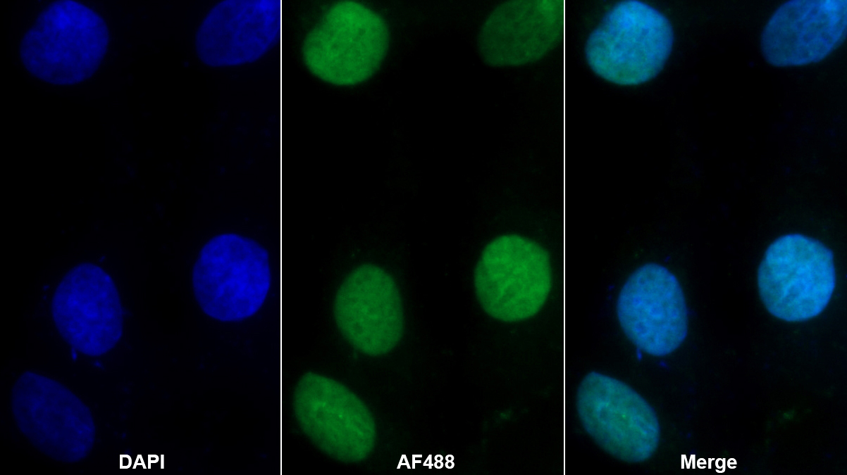 Polyclonal Antibody to H2A Histone Family, Member X (H2AFX)