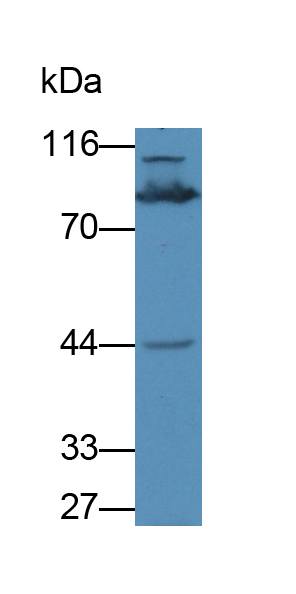 Polyclonal Antibody to Leucine Rich Repeat Containing Protein 32 (LRRC32)