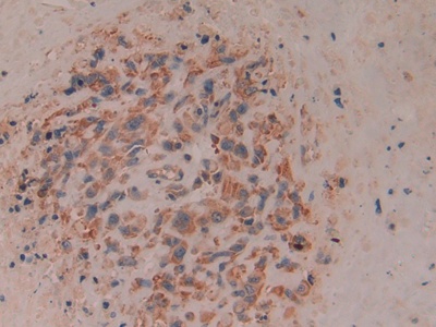 Polyclonal Antibody to Cluster Of Differentiation 8b (CD8b)