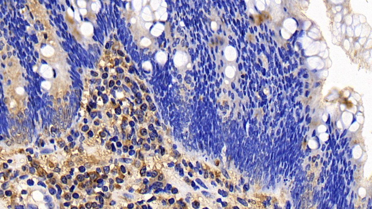 Polyclonal Antibody to Bcl2 Like Protein 11 (BCL2L11)