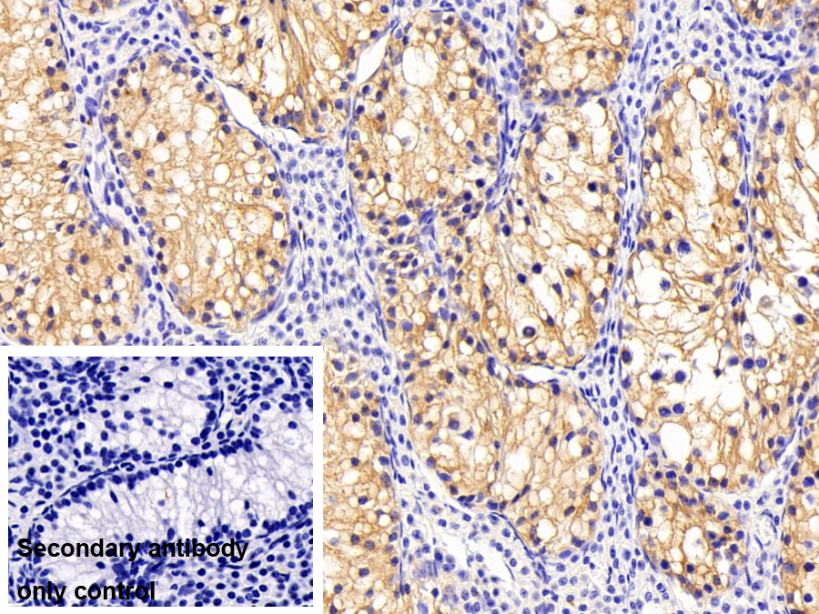Polyclonal Antibody to Tubulin Alpha 1C (TUBa1C)