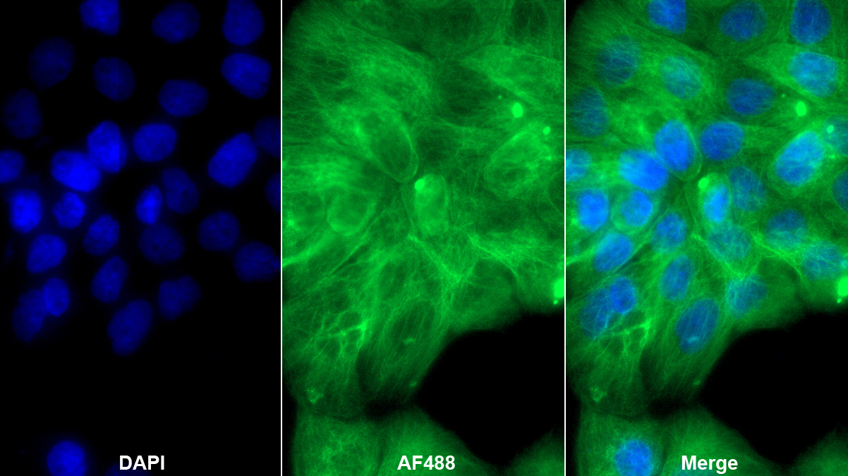 Polyclonal Antibody to Tubulin Alpha 1C (TUBa1C)