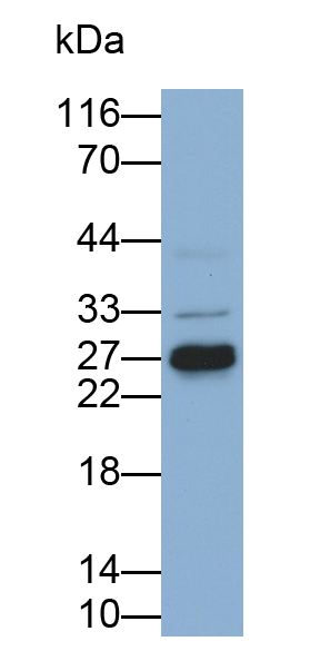 Polyclonal Antibody to Coiled Coil Domain Containing Protein 3 (CCDC3)