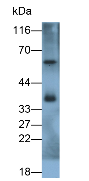 Polyclonal Antibody to MOCO Sulphurase C-Terminal Domain Containing Protein 1 (MOSC1)