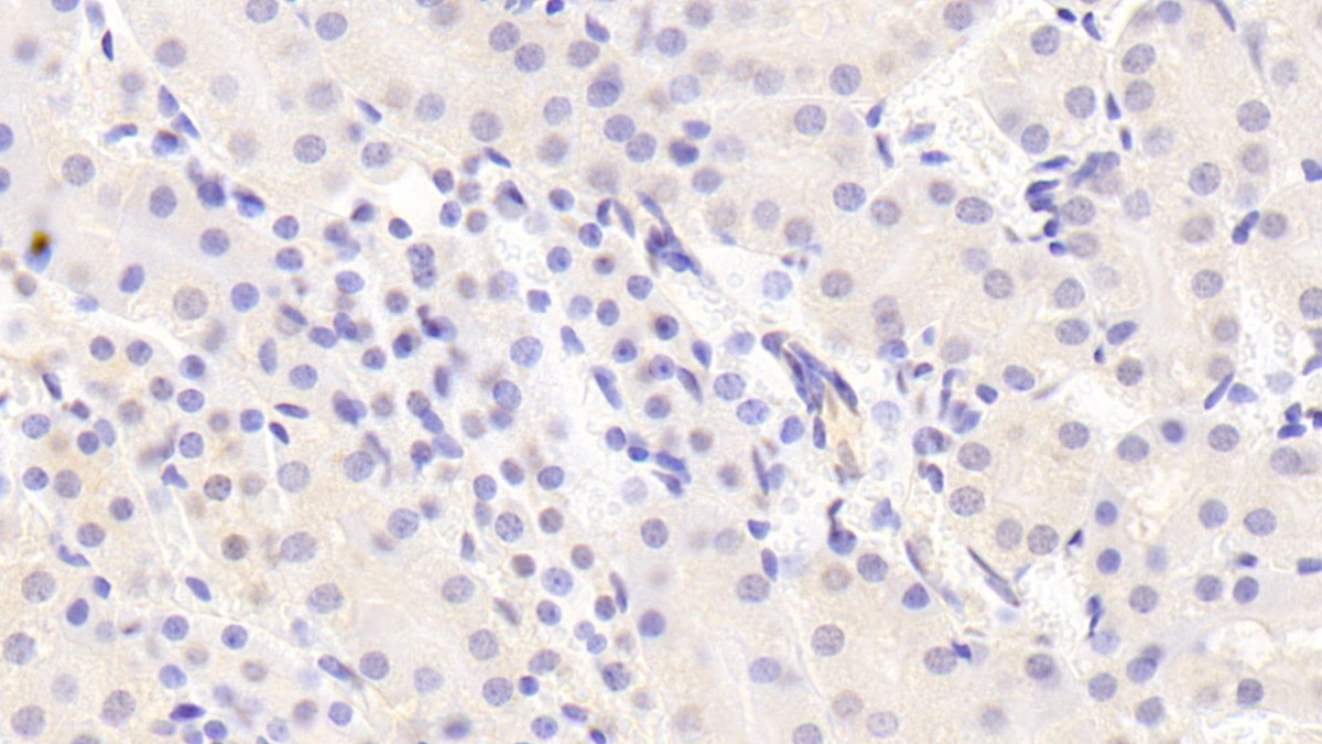 Polyclonal Antibody to Raft Linking Protein (Raftlin)