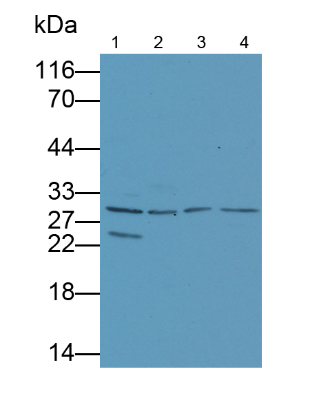 Polyclonal Antibody to Notch2 N-Terminal Like Protein (NOTCH2NL)