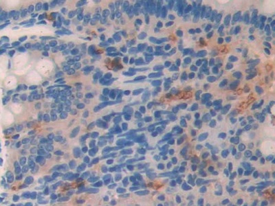 Polyclonal Antibody to Lipocalin Like Protein 1 (LCNL1)