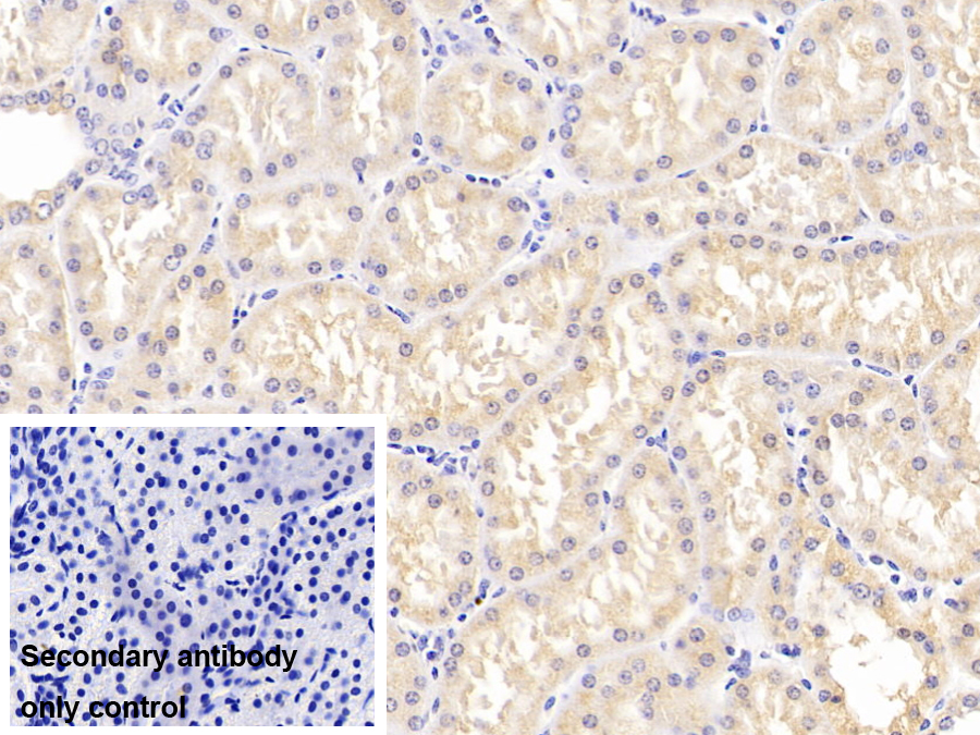 Polyclonal Antibody to Galectin 9C (GAL9C)