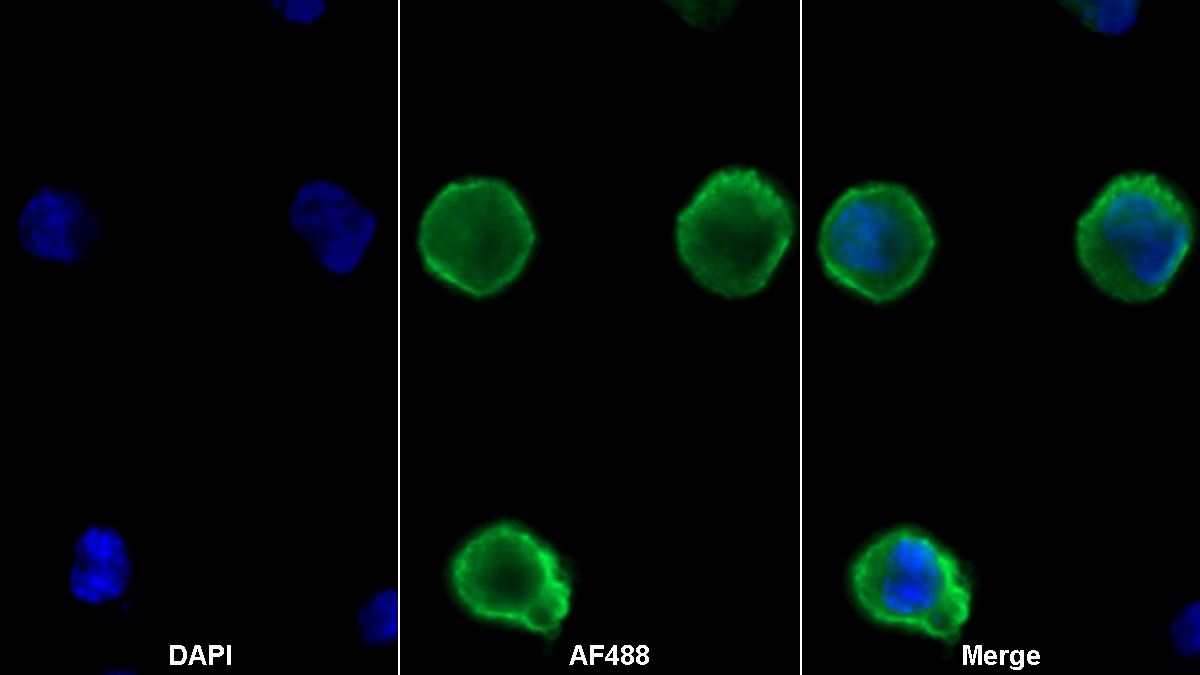 Recombinant Antibody to Programmed Cell Death Protein 1 Ligand 1 (PDL1)