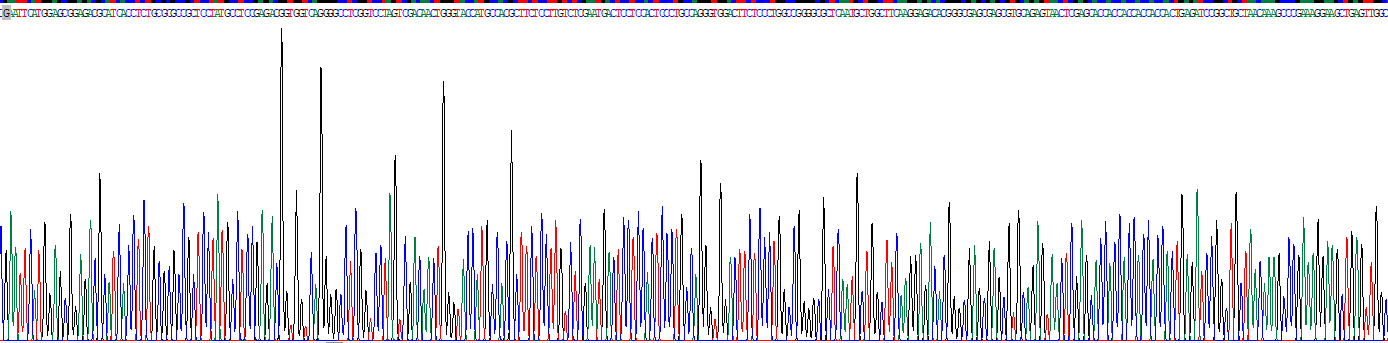 Recombinant Glial Fibrillary Acidic Protein (GFAP)