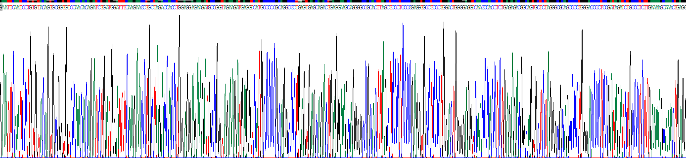 Recombinant Atrial Natriuretic Peptide (ANP)