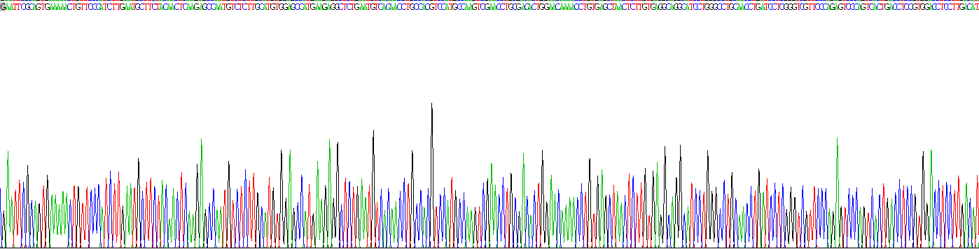 Recombinant Interleukin 2 Receptor Beta (IL2Rb)