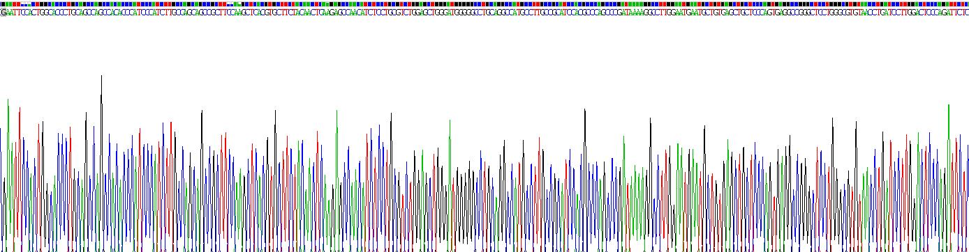Recombinant Interleukin 2 Receptor Beta (IL2Rb)