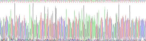 Recombinant Beta-2-Microglobulin (b2M)