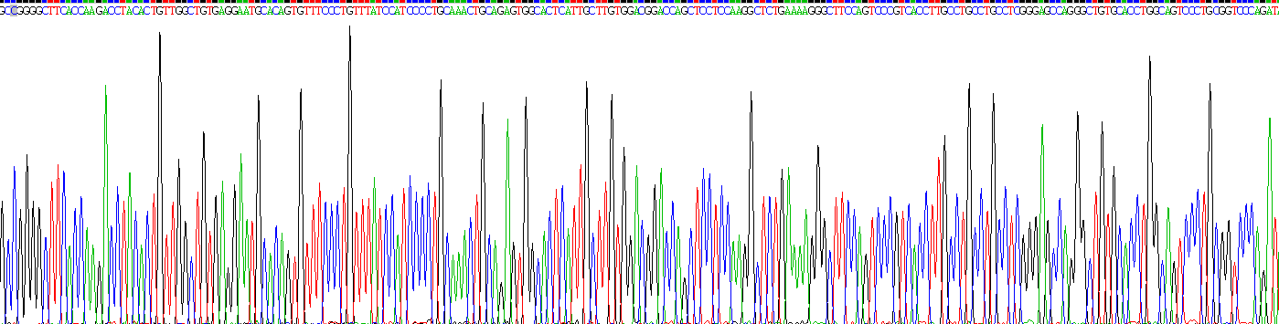 Recombinant Tissue Inhibitors Of Metalloproteinase 1 (TIMP1)