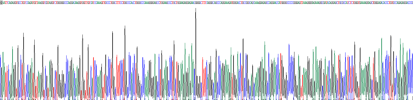 Recombinant Ficolin 1 (FCN1)