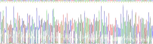 Recombinant Alpha-1-Acid Glycoprotein (a1AGP)