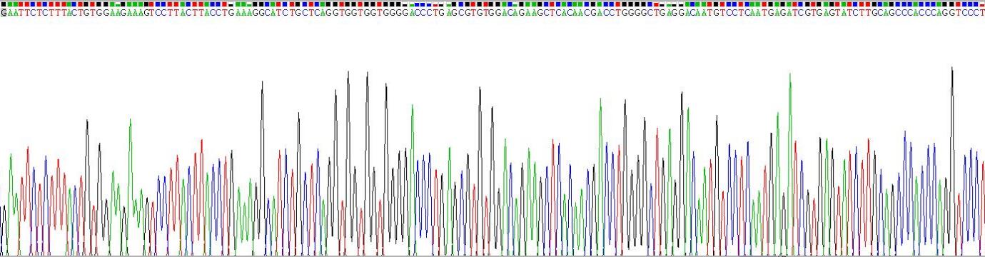 Recombinant Death receptor 5 (DR5)