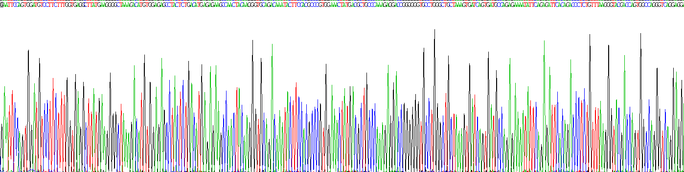 Recombinant Serum Amyloid A (SAA)