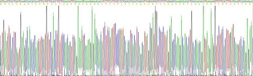 Recombinant Serpin B3 (SERPINB3)