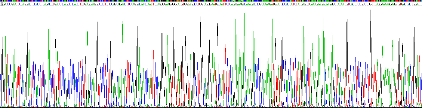 Recombinant Neutrophil gelatinase-associated lipocalin (NGAL)