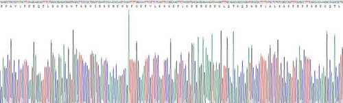 Recombinant Calreticulin (CALR)