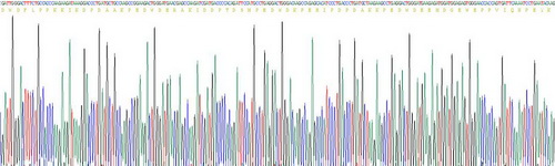 Recombinant Calreticulin (CALR)