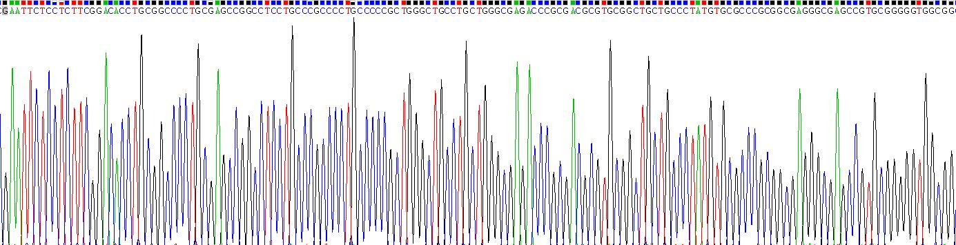 Recombinant Insulin Like Growth Factor Binding Protein 7 (IGFBP7)
