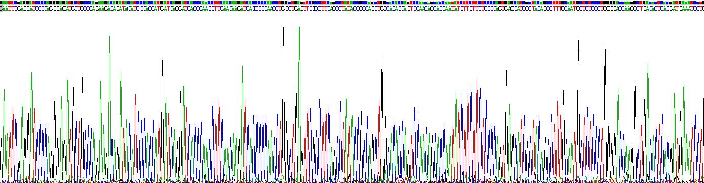 Recombinant Alpha-1-Antitrypsin (a1AT)