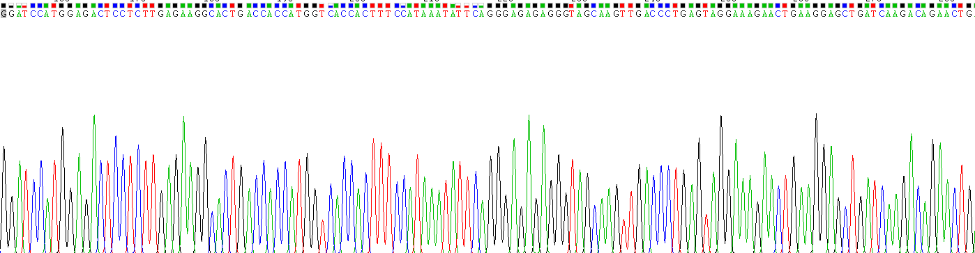 Recombinant S100 Calcium Binding Protein A5 (S100A5)