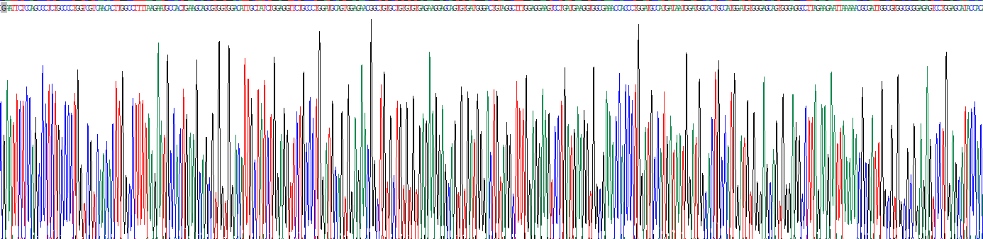 Recombinant Aspartylglucosaminidase (AGA)