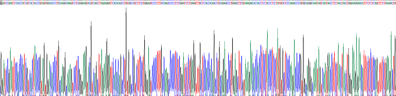 Recombinant Carboxylesterase 1 (CES1)