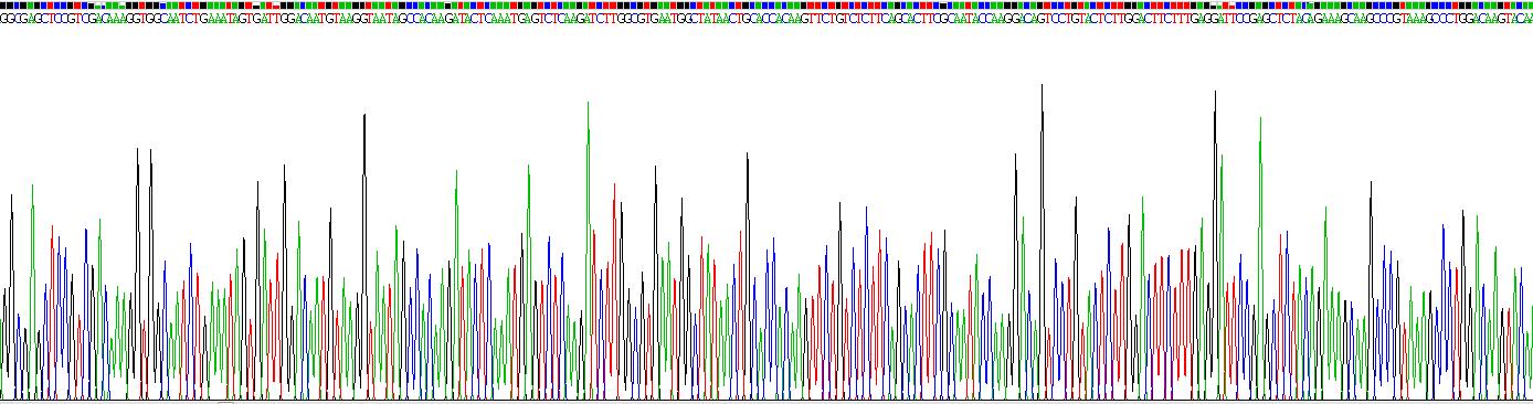 Recombinant Histidine Rich Glycoprotein (HRG)