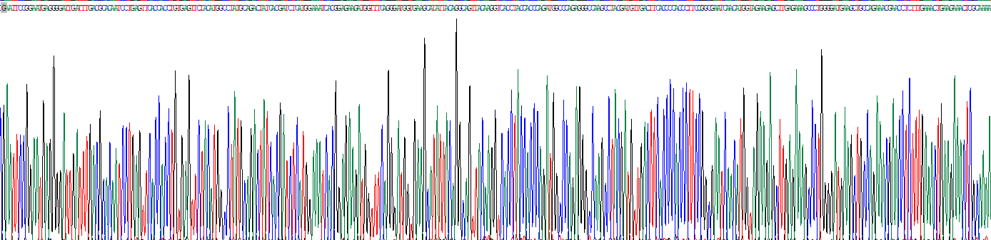 Recombinant Lysyl tRNA Synthetase (KARS)