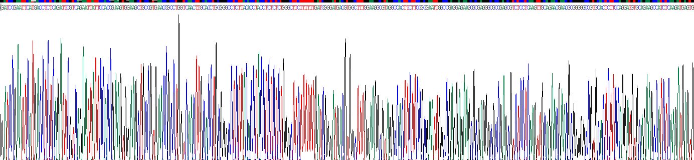 Recombinant Ferritin, Light Polypeptide (FTL)