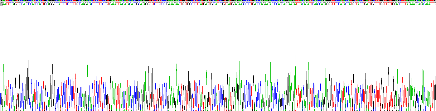 Recombinant Leukotriene A4 Hydrolase (LTA4H)